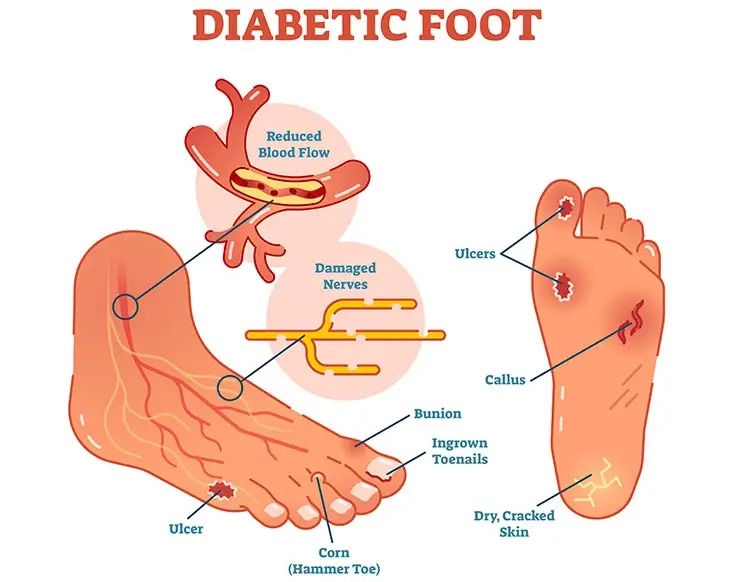 Parathyroidism Treatment Jammu